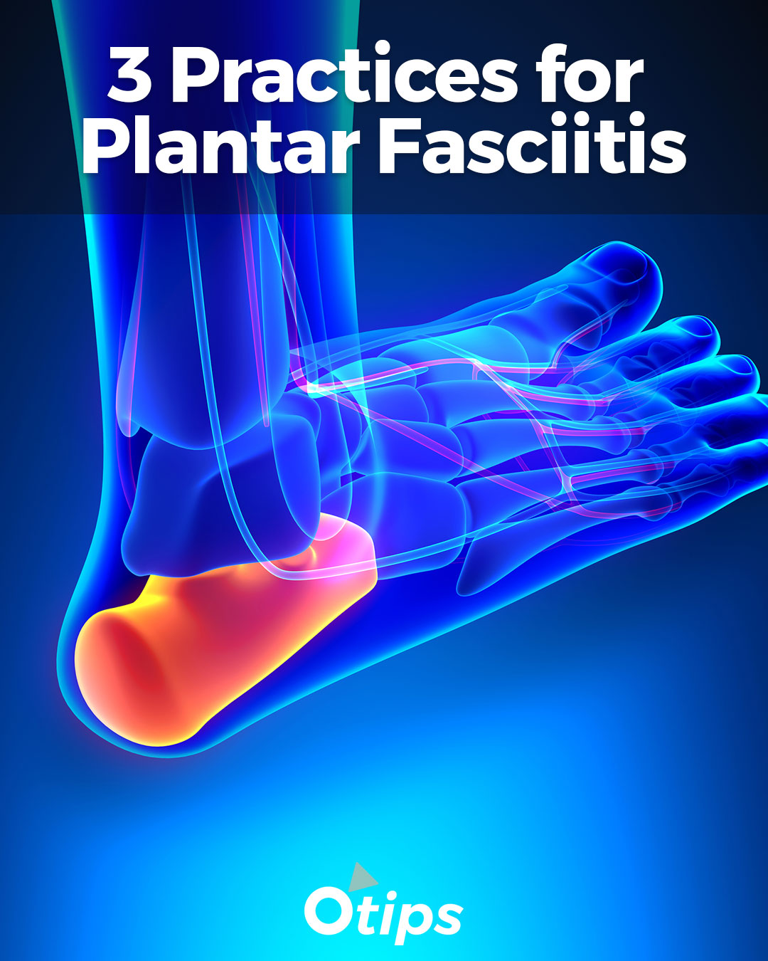 3 Tips for Plantar Fasciitis – Onecompress